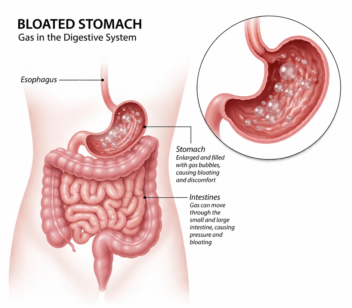 Best medicine for stomach gas